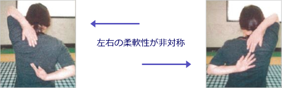 左右の柔軟性が非対称